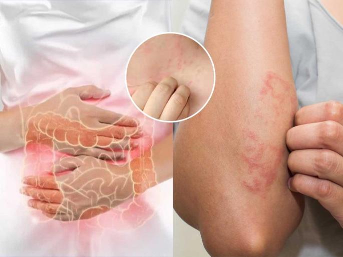 Is increased acidity causing problems? Just make simple changes in your diet, you won't have to take a single pill. | पित्त वाढून देतं त्रास? फक्त आहारात करा साधे बदल, एकही गोळी घ्यावी लागणार नाही Is increased acidity causing problems? Just make simple changes in your diet, you won't have to take a single pill. | पित्त वाढून देतं त्रास? फक्त आहारात करा साधे बदल, एकही गोळी घ्यावी लागणार नाही