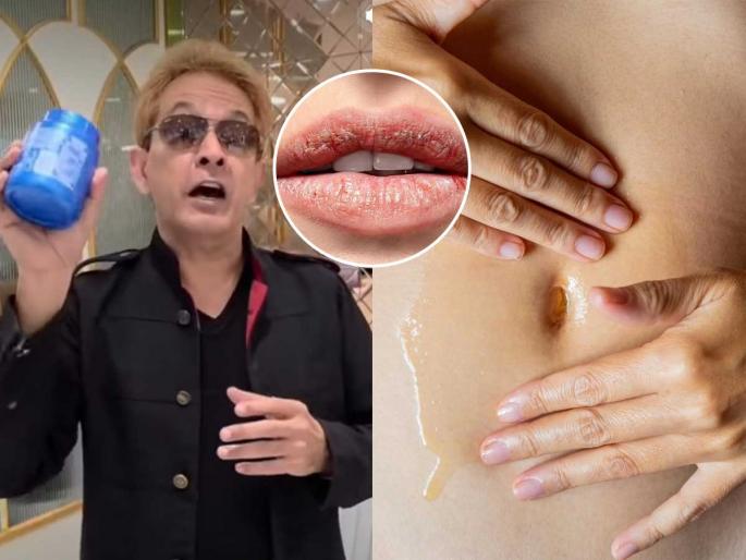 Crack Lips Solution Jawed Habib Says Apply Coconut Oil Or Mustard Oil in Belly Button To Get Soft Lips | ओठ खूपच फाटलेत? जावेद हबीब सांगतात बेंबीत 'हे' तेल लावा; मऊ-गुलाबी होतील ओठ