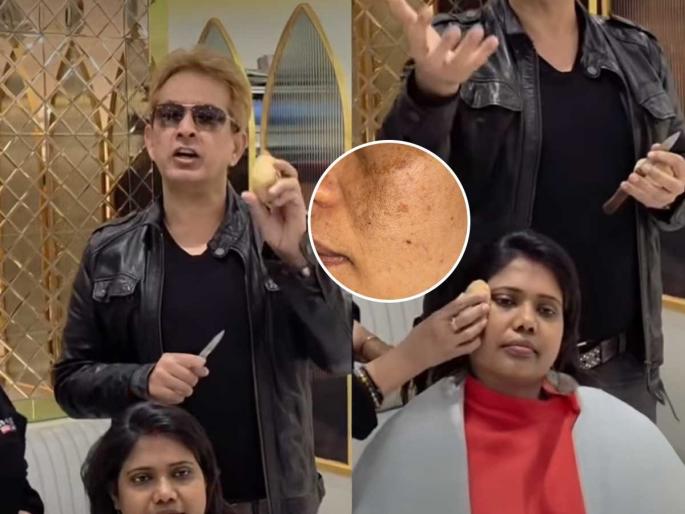 Jawed Habib Says Apply Potato On Your Face to Get Rid Of Pigmentation | चेहऱ्यावर काळपट डाग आले? जावेद हबीब सांगतात 'हा' पदार्थ लावा; लगेच चेहऱ्यावर येईल तेज Jawed Habib Says Apply Potato On Your Face to Get Rid Of Pigmentation | चेहऱ्यावर काळपट डाग आले? जावेद हबीब सांगतात 'हा' पदार्थ लावा; लगेच चेहऱ्यावर येईल तेज