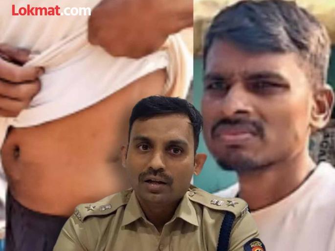 Every transaction, including the Cambodian link, will be investigated in the case of 'that' farmer's kidney sale | 'त्या' शेतकऱ्याच्या किडनी विक्री प्रकरणी कंबोडियाच्या लिंकसह प्रत्येक व्यवहार तपासल्या जाणार Every transaction, including the Cambodian link, will be investigated in the case of 'that' farmer's kidney sale | 'त्या' शेतकऱ्याच्या किडनी विक्री प्रकरणी कंबोडियाच्या लिंकसह प्रत्येक व्यवहार तपासल्या जाणार