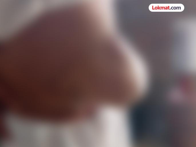 Hernia surgery on 78-year-old man who was deemed 'unfit' is successful! | ‘अनफिट’ ठरवलेल्या ७८ वर्षीय वृद्धावर ‘हर्निया’ची शस्त्रक्रिया यशस्वी ! Hernia surgery on 78-year-old man who was deemed 'unfit' is successful! | ‘अनफिट’ ठरवलेल्या ७८ वर्षीय वृद्धावर ‘हर्निया’ची शस्त्रक्रिया यशस्वी !