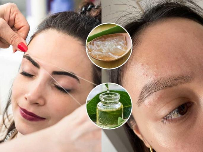 home hacks to to get relief from irritation and redness around eyebrows after threading | आयब्रो करताच चेहरा लाल होऊन भप्प सुजतो? ३ उपाय- अजिबात जळजळ होणार नाही home hacks to to get relief from irritation and redness around eyebrows after threading | आयब्रो करताच चेहरा लाल होऊन भप्प सुजतो? ३ उपाय- अजिबात जळजळ होणार नाही