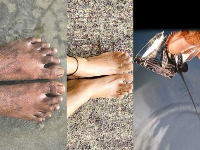 How To Remove Feet Tanning : How To Remove Tanning Form Legs Using 1 Rupees Shampoo | उन्हामुळे पाय काळवंडले? १ रुपयांचा शाम्पू सॅशे आणा-सोपा उपाय-पाय होतील स्वच्छ How To Remove Feet Tanning : How To Remove Tanning Form Legs Using 1 Rupees Shampoo | उन्हामुळे पाय काळवंडले? १ रुपयांचा शाम्पू सॅशे आणा-सोपा उपाय-पाय होतील स्वच्छ