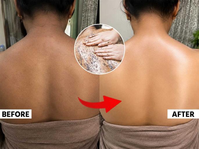 home made body scrub for body polishing, how to make home made body scrub to clan back and neck tanning | पाठ काळी पडली, फोडंही खूप आहेत? 'हा' घरगुती उपाय करा, बॉडी पॉलिशिंगसारखा इफेक्ट मिळेल home made body scrub for body polishing, how to make home made body scrub to clan back and neck tanning | पाठ काळी पडली, फोडंही खूप आहेत? 'हा' घरगुती उपाय करा, बॉडी पॉलिशिंगसारखा इफेक्ट मिळेल