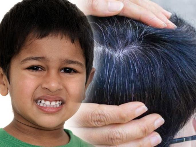 Here are 7 reasons why children's hair starts turning white. And 5 home remedies for it. | लहान मुलांचे केसही पांढरे होऊ लागलेत, त्याची ही 7 कारणं आणि त्यावर 5 उपाय