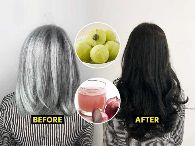 how to stop premature white of hair naturally at home best amala oil onion oil and methi dana seeds to reduce hair fall and white hair natural ways to make hair dark and thick without chemicals | ऐन तारुण्यात केस पांढरे, भरपूर गळतातही? स्वयंपाकघरातील ३ गोष्टी ठरतील असरदार, होतील काळे- जाडजूड