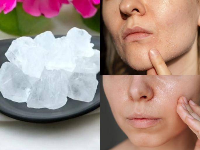 Is alum suitable for all skin types Know who should not use alum on Skin Who should avoid using alum on Skin Who should skip using fitkari on skin | तुरटी त्वचेसाठी फायदेशीर म्हणून चेहऱ्याला लावाल तर पस्तावाल! पाहा कुणी तुरटी वापरु नये...