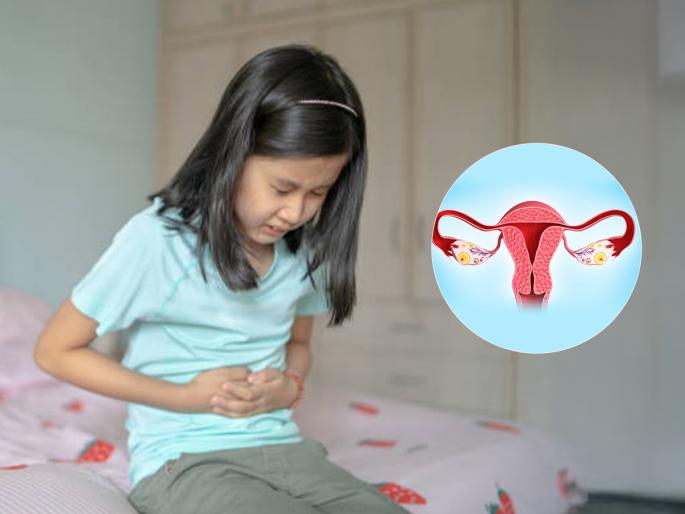 Why do girls get their periods at a young age? Experts tell us 4 main reasons, to take care of girls... | कमी वयातच मुलींना पाळी का येते? तज्ज्ञांनी सांगितली ४ मुख्यं कारणं, मुलींची काळजी घेण्यासाठी...
