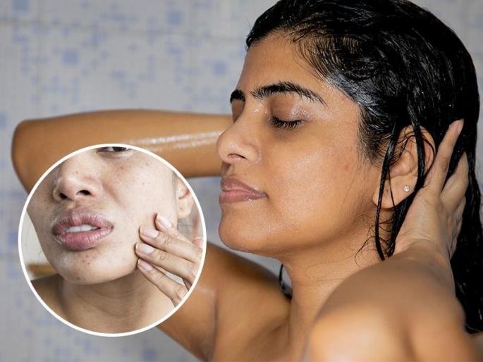 Keep 5 Rules of bath in winter for soft skin | थंडीत आंघोळीनंतर त्वचा होते कोरडी-खरखरीत.. 5 नियम पाळले तरच त्वचा राहील मऊ मुलायम