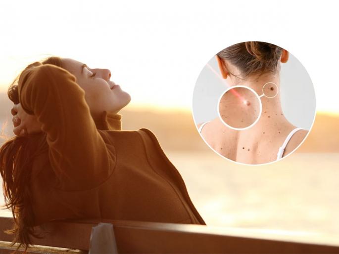 sitting too long under the sun can cause skin cancer do not make these mistakes | थंडी वाजते म्हणून जास्त वेळ उन्हात बसत असाल तर सावधान, स्किन कॅन्सरचा मोठा धोका