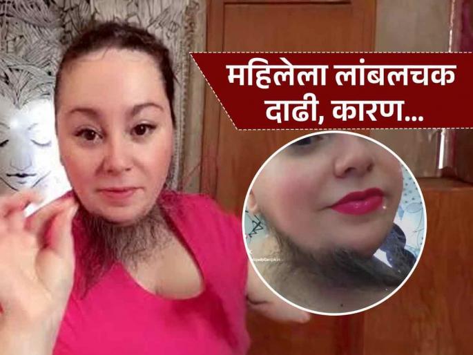 Woman having pcos condition fed up with shaving beard finally decide to grow beard | महिलेनं वाढवली पुरुषांसारखी लांब दाढी, आवड म्हणून नाही एका आजाराचा गंभीर परिणाम