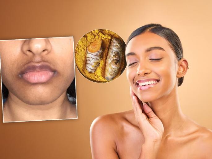 skincare tips, Dark pigmentation near the lips? See the reasons, never make these mistakes | ओठांजवळ काळा थर-पिंगमेंटेशन? पाहा कारणं, कधीच करु नका ‘या’ चुका