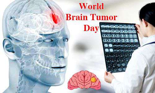 Brain tumor alcohol consumption, cigarettes, and tobacco consumption in the world are threatened by 500 people every day! | जगभरात दररोज ५०० जणांना होतो ब्रेन ट्युमर मद्य प्राशन, सिगारेट, तंबाखू सेवनामुळे धोका ! Brain tumor alcohol consumption, cigarettes, and tobacco consumption in the world are threatened by 500 people every day! | जगभरात दररोज ५०० जणांना होतो ब्रेन ट्युमर मद्य प्राशन, सिगारेट, तंबाखू सेवनामुळे धोका !