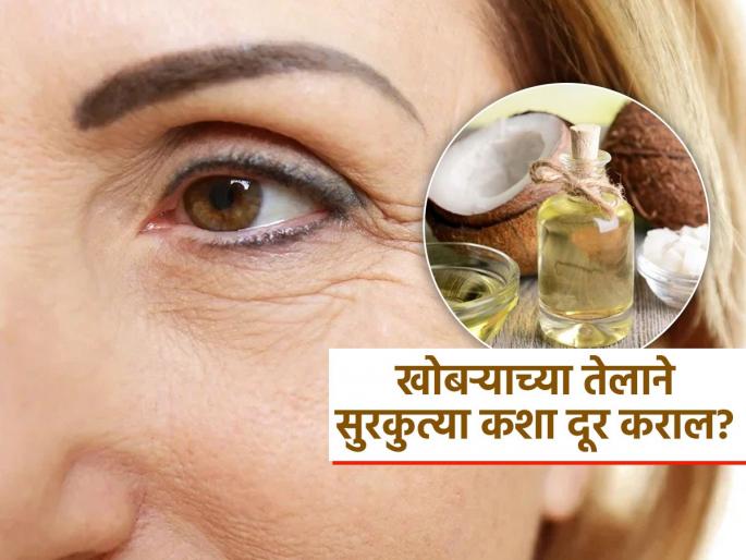 How to reduce wrinkles on face naturally know how to use coconut oil for it | कमी वयात आलेल्या सुरकुत्या खोबऱ्याचं तेल करेल दूर, पण माहीत असली पाहिजे वापरण्याची योग्य पद्धत How to reduce wrinkles on face naturally know how to use coconut oil for it | कमी वयात आलेल्या सुरकुत्या खोबऱ्याचं तेल करेल दूर, पण माहीत असली पाहिजे वापरण्याची योग्य पद्धत