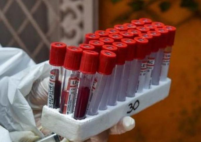 CoronaVirus: Waiting for CERO survey in Washim district! | CoronaVirus : वाशिम जिल्ह्यात सेरो सर्वेक्षणची प्रतिक्षाच! CoronaVirus: Waiting for CERO survey in Washim district! | CoronaVirus : वाशिम जिल्ह्यात सेरो सर्वेक्षणची प्रतिक्षाच!
