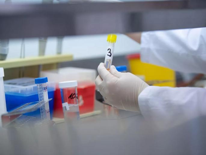 Yavatmal ranks second in lab tests | लॅब चाचण्यामध्ये यवतमाळ द्वितीय क्रमांकावर Yavatmal ranks second in lab tests | लॅब चाचण्यामध्ये यवतमाळ द्वितीय क्रमांकावर