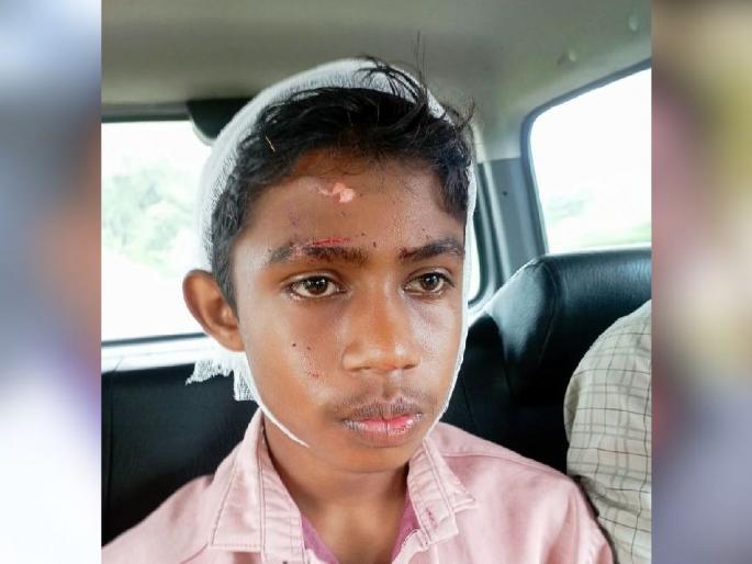 A school boy injured in a collision with an unknown four-wheeler | अज्ञात चारचाकी वाहनाच्या धडकेत शाळकरी बालक जखमी A school boy injured in a collision with an unknown four-wheeler | अज्ञात चारचाकी वाहनाच्या धडकेत शाळकरी बालक जखमी