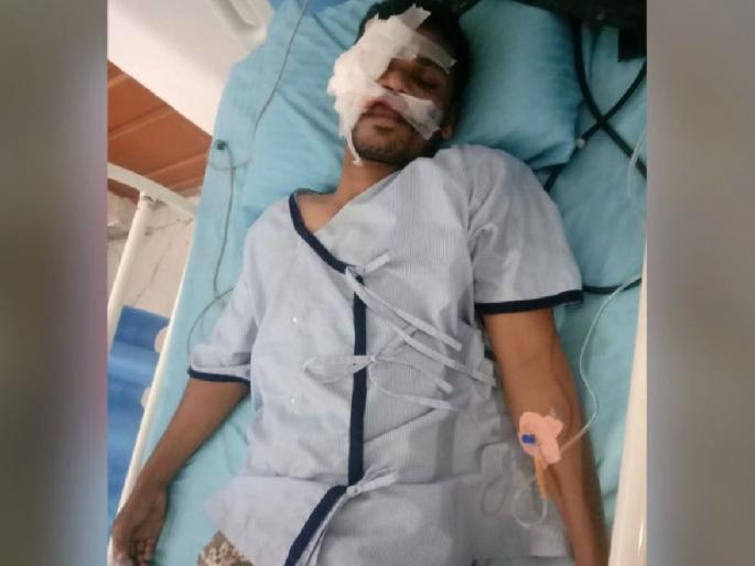 A forest guard who was blocking the transport of sand from the forest area was hit by a tractor, one detained | वनक्षेत्रातून रेती वाहतूक रोखणाऱ्या वनरक्षकाच्या अंगावरच घातला ट्रॅक्टर A forest guard who was blocking the transport of sand from the forest area was hit by a tractor, one detained | वनक्षेत्रातून रेती वाहतूक रोखणाऱ्या वनरक्षकाच्या अंगावरच घातला ट्रॅक्टर