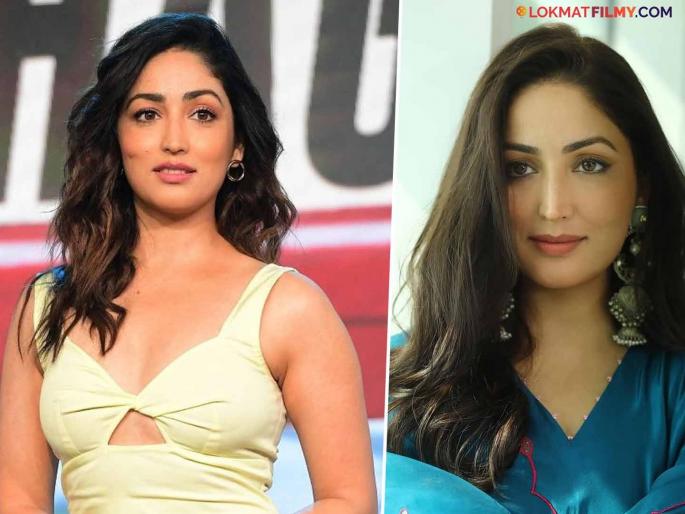 bollywood actress yami gautam battling skin problem keratosis pilaris disease since many years  | अनेक वर्ष 'या' गंभीर आजाराचा सामना करतेय यामी गौतम! उपचारही घेऊ शकत नाही, कारण...