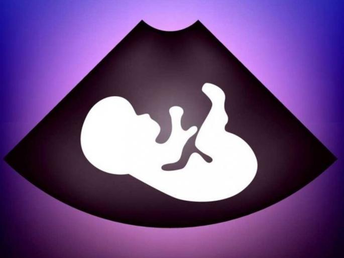 It is a shocking fact that girls are having miscarriages | ...मग नवरी मिळेल तरी कशी? ‘मुला’चा अट्टहास कायम, राज्यातील २२ जिल्ह्यांत मुलींचा जन्मदर घटला It is a shocking fact that girls are having miscarriages | ...मग नवरी मिळेल तरी कशी? ‘मुला’चा अट्टहास कायम, राज्यातील २२ जिल्ह्यांत मुलींचा जन्मदर घटला