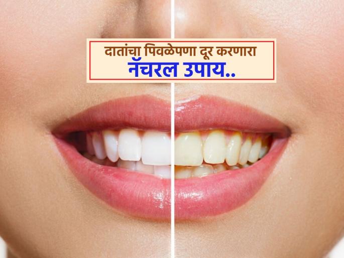 According to expert you can use banana peels to cleaning yellow teeth | केमिकल्सचा नाद सोडा या फळाच्या सालीनं पिवळे दात चमकदार करा, खर्चही येईल कमी!