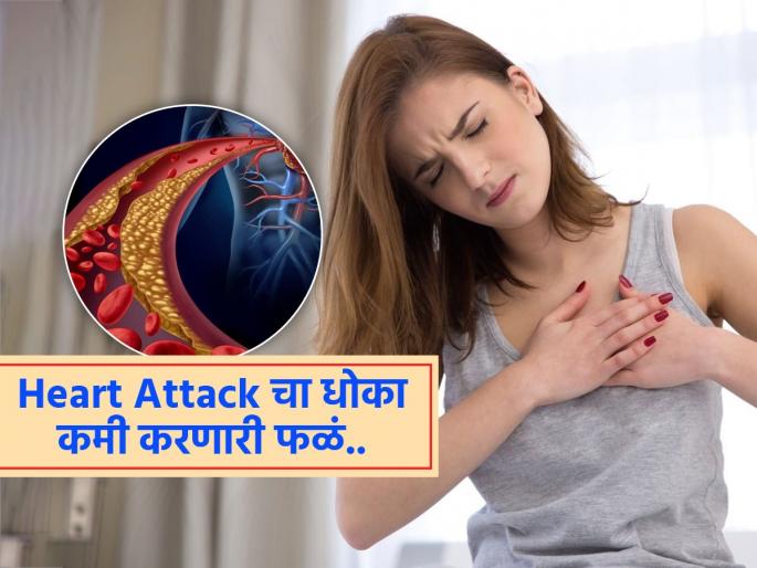 5 yellow fruits to reduce high cholesterol bad cholesterol | Heart Attack आणणारं हाय कोलेस्टेरॉल कमी करतात 'ही' पिवळी फळं, रोज खा जिवाचा धोका टाळा!
