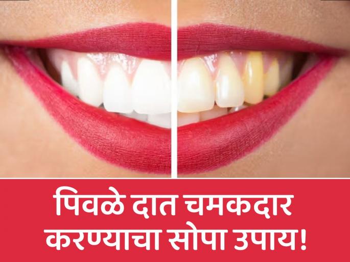 Know the benefits of salt and mustard oil for yellow teeth | मोहरीचं तेल आणि मिठाचा वापर करून पिवळे दात करा चमकदार, जाणून घ्या कसा कराल वापर! Know the benefits of salt and mustard oil for yellow teeth | मोहरीचं तेल आणि मिठाचा वापर करून पिवळे दात करा चमकदार, जाणून घ्या कसा कराल वापर!