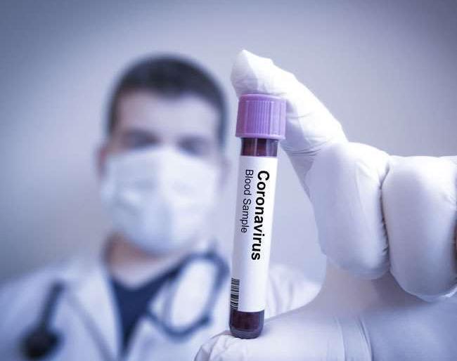 Two Hockey India employees corona positive | हॉकी इंडियाचे दोन कर्मचारी कोरोना पॉझिटिव्ह