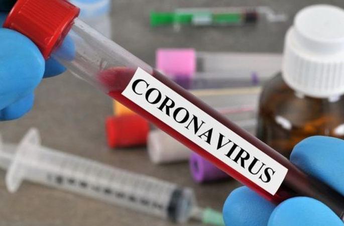 Another 30 corona affected in Washim district | वाशिम जिल्ह्यात आणखी ३० कोरोनाबाधित Another 30 corona affected in Washim district | वाशिम जिल्ह्यात आणखी ३० कोरोनाबाधित