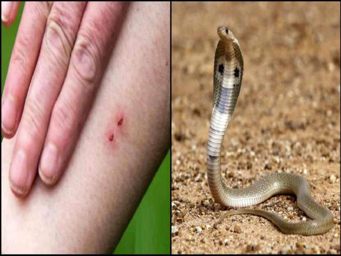 man was in denial even after being bitten by a poisonous snake; doctor saved the lives of the husband and wife | विषारी साप चावल्यानंतरही 'तो' नाकारातच होता; डॉक्टरांचे प्रसंगावधान, पती-पत्नीचे वाचले प्राण man was in denial even after being bitten by a poisonous snake; doctor saved the lives of the husband and wife | विषारी साप चावल्यानंतरही 'तो' नाकारातच होता; डॉक्टरांचे प्रसंगावधान, पती-पत्नीचे वाचले प्राण