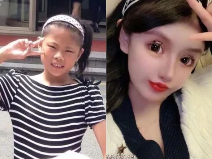 girl obsessed with plastic surgery 100 procedures till now story shocked people | बापरे! सुंदर दिसण्याची भलतीच हौस; 100 प्लास्टिक सर्जरी, खर्च केले तब्बल 4.66 कोटी girl obsessed with plastic surgery 100 procedures till now story shocked people | बापरे! सुंदर दिसण्याची भलतीच हौस; 100 प्लास्टिक सर्जरी, खर्च केले तब्बल 4.66 कोटी
