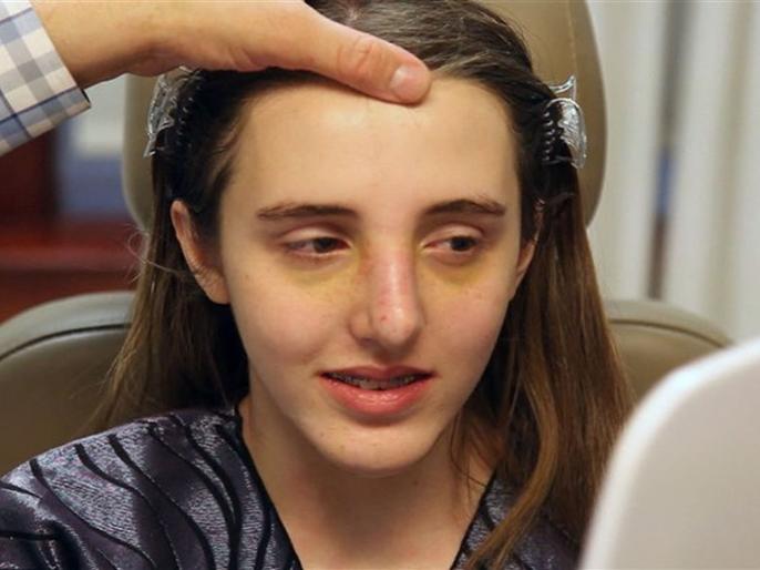 plastic surgery side effects in Hindi Woman loses her legs after