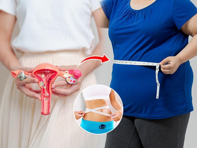 How to Lose Weight With PCOS (2026 Guide): Doctor ... - Wholesomealive