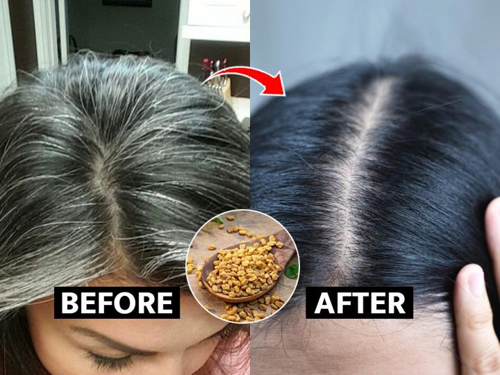 8 Natural Remedies To Get Rid Of White Hair At A Young Age