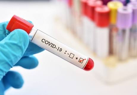 Corona virus: Increase of 1006 corona virus in Pune city on Thursday, total number of patients 25 thousand 174 | Corona virus : पुणे शहरात गुरुवारी १००६ कोरोनाबाधितांची वाढ, एकूण रुग्णसंख्या २५ हजार १७४