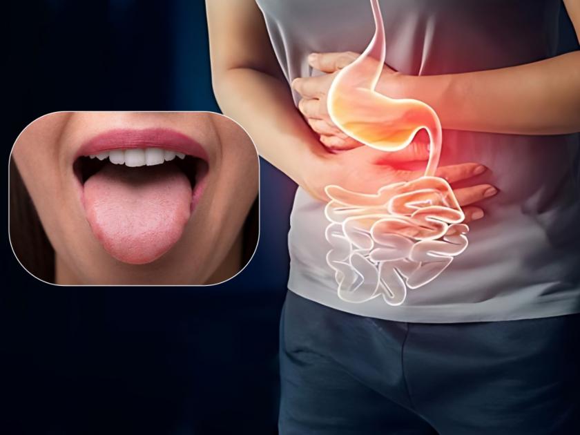 According to Dietician Manpreet tongue colour revealed toxins present in body | शरीरात 'विष' जमा करतात हे टॉक्सिन, जिभेवर दिसतात ही लक्षणं; वेळीच व्हा सावध!