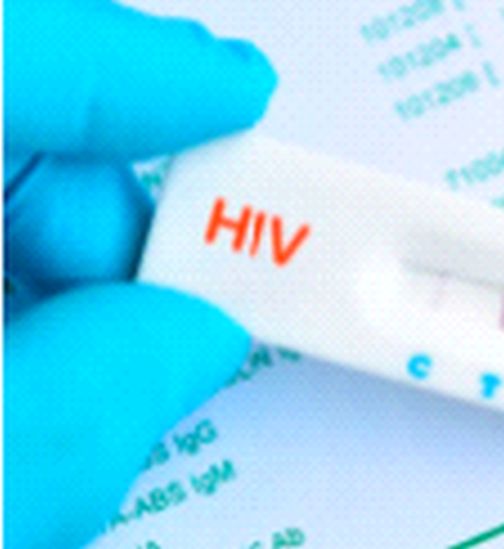 84 AIDS patients were found during the lockdown | लॅाकडाऊनच्या काळात आढळले ८४ एड्‌स रुग्ण