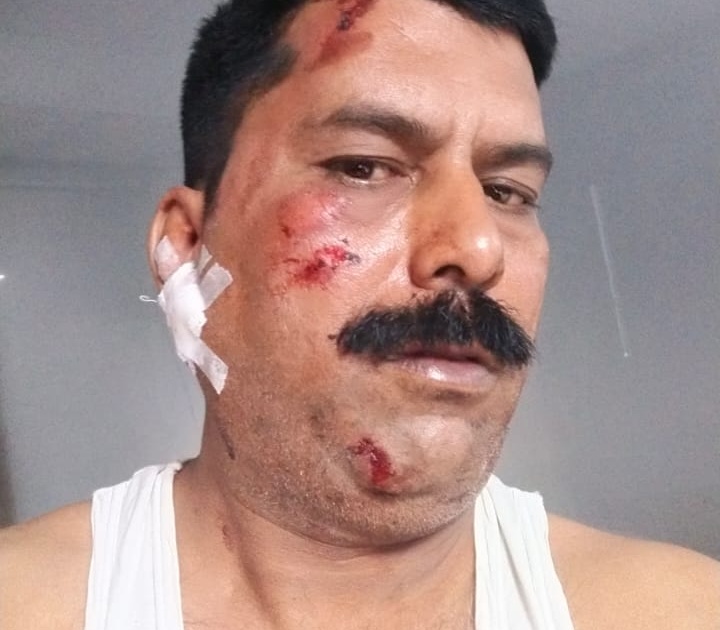 Chaighe injured in Kajgaon doctor's car accident | कजगाव येथील डाॅक्टरांच्या गाडीला अपघात, चाैघे जखमी