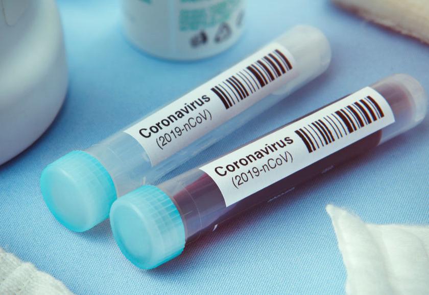 Coronavirus: India will soon have one lakh corona tests per day | Coronavirus: भारतात लवकरच दररोज एक लाख कोरोना टेस्ट होणार