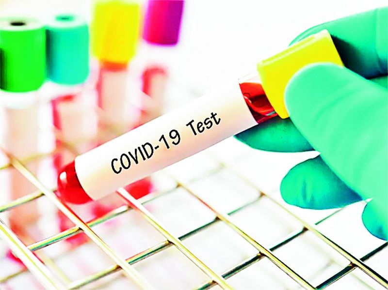 There are fewer covid tests in May than in April | एप्रिलच्या तुलनेत मे महिन्यात होत आहेत कमी कोविड टेस्ट