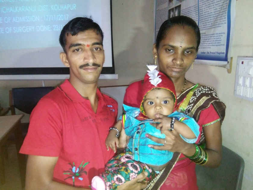 Ijchalkaranji's five-month old Viraj, successful surgery in CPR; A large tumor removed from the stomach | इचलकरंजीतील पाच महिन्यांच्या ‘विराज’ला जीवदान, सीपीआरमध्ये यशस्वी शस्त्रक्रिया; पोटातील मोठा ट्युमर काढला