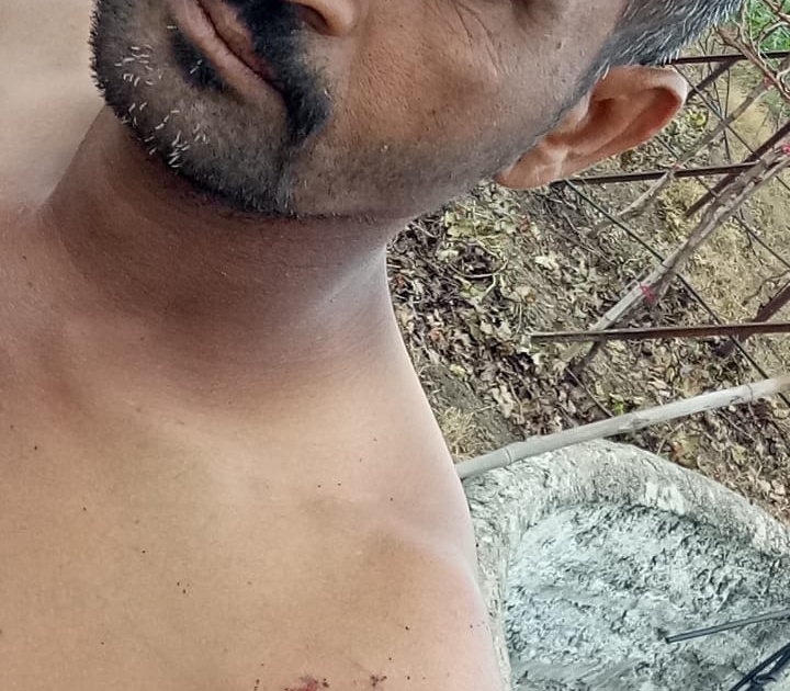 Farmer injured in leopard attack | बिबट्याच्या हल्ल्यात शेतमजूर जखमी
