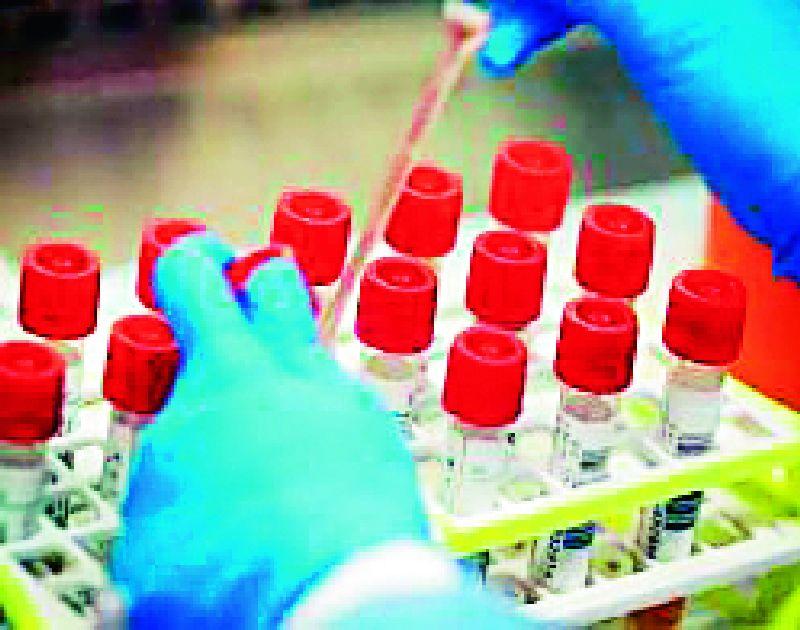 Preparing to buy one lakh antigen kits | एक लाख अ‍ॅन्टीजेन किट खरेदी करण्याची तयारी