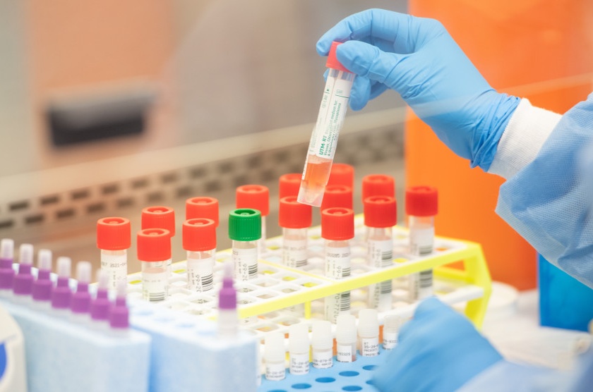 Demand for Corona Testing Lab in the District | जिल्ह्यात कोरोना टेस्टिंग लॅबची मागणी