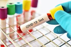 Corona virus Pune News: 1thousand 366 new patients in pune city on Wednesday | Corona Virus Pune News: पुणे शहरात बुधवारी  १ हजार ३३६ नवे कोरोनाबाधित; ६६ जणांचा मृत्यू