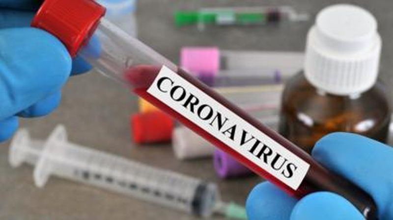 one death in Amravati, two positives in a day | Corona Virus in Amravati; अमरावतीत कोरोनाग्रस्ताचा मृत्यू, दिवसभरात दोन पॉझिटिव्ह