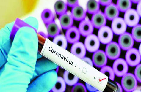 Corona virus: 1598 corona infections in one day in Pune district; Total number 35 thousand 997 | Corona virus :पुणे जिल्ह्यात एका दिवसात १५९८ कोरोनाबाधित; एकूण संख्या ३५ हजार ९९७
