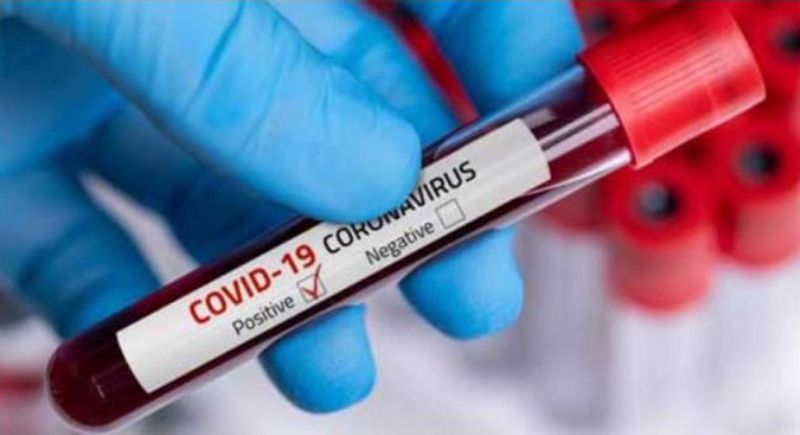 Corona Virus in Nagpur: 319 new positive in Nagpur, 5 deaths | CoronaVirus in Nagpur : नागपुरात ३१९ नवीन पॉझिटिव्ह, ५ जणांचा मृत्यू