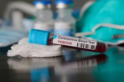 Corona virus : 90% of the cost has to be paid for the treatment of corona patients in haveli taluka | Corona virus : हवेली तालुक्यात कोरोनाबाधित रुग्णांवरील उपचारासाठी भरावे लागतात ९० टक्के पैसे