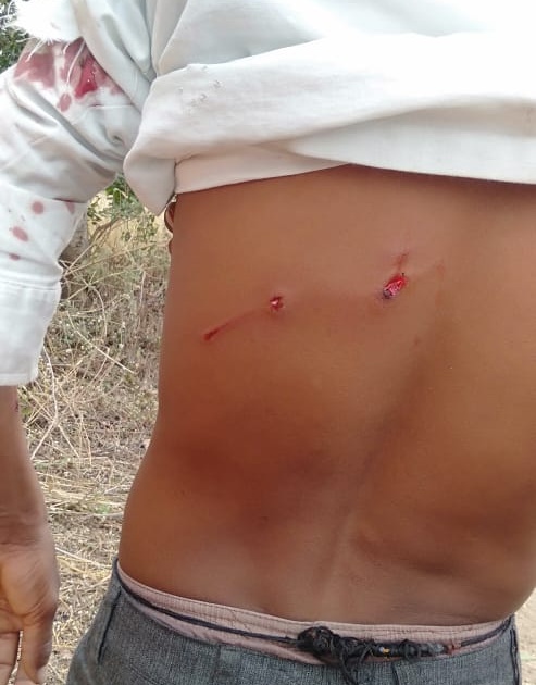 Leopard attacks youth in Bhardupari field | बिबट्याचा भरदुपारी शेतात युवकावर हल्ला